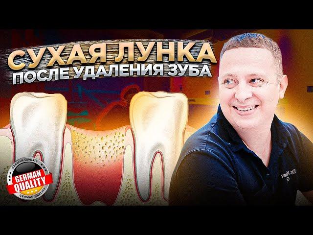 Сухая лунка - синдром после удаления зуба мудрости