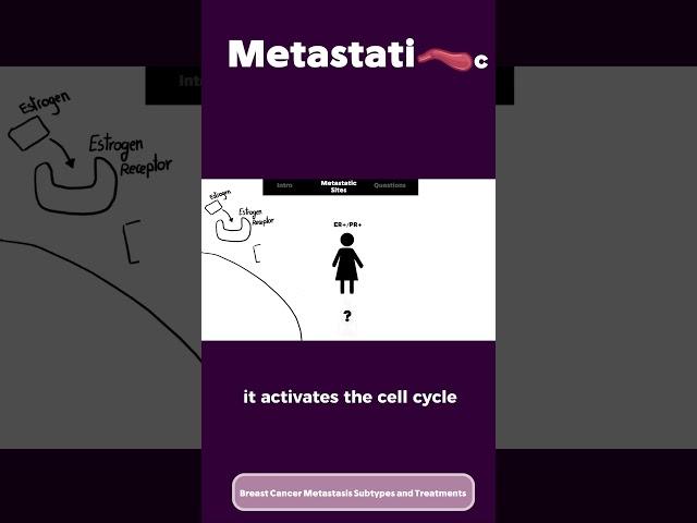 Breast Cancer Metastasis part 1