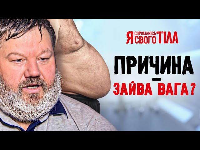 Нетримання сечі у чоловіка – Я соромлюсь свого тіла | ЛІКУВАННЯ | ДОКАЗОВА МЕДИЦИНА | ХВОРОБИ
