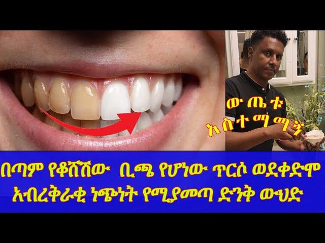 Ethiopia | በጣም የቆሸሽው  ቢጫ የሆነው ጥርሶ ወደቀድሞ አብረቅራቂ ነጭነት የሚያመጣ ድንቅ ውህድ | ውጤቱ አስተማማኝ