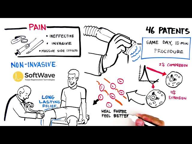 What is Softwave Technology? Pain Relief - Tissue Regeneration