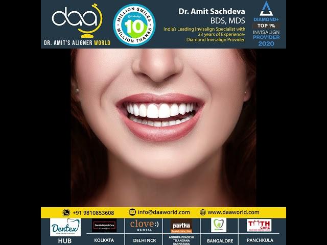 Invisalign - the most advanced clear aligner system