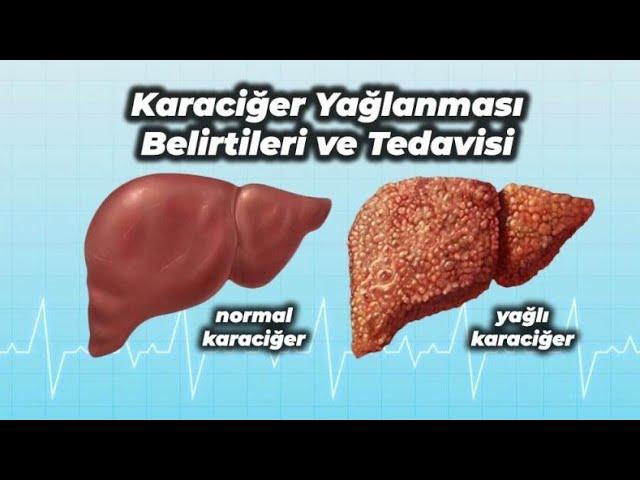 karaciğer yağlanması ve toksin atımı için mutlaka yapın