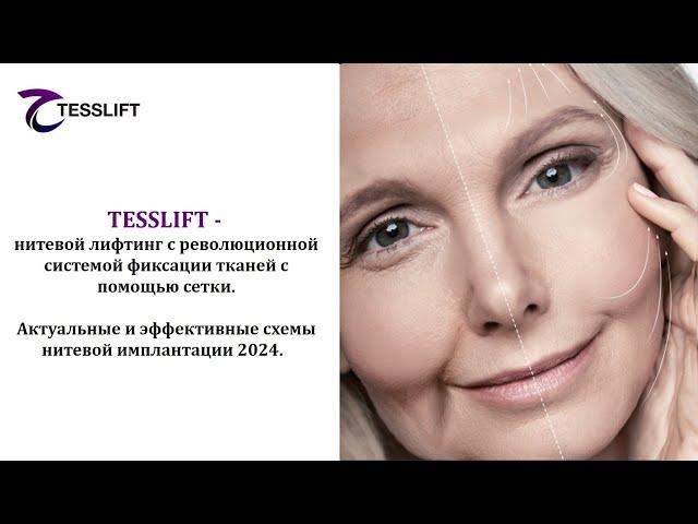 TESSLIFT - нитевой лифтинг с революционной системой фиксации тканей с помощью сетки.