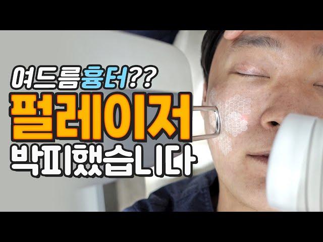 여드름흉터치료 박피레이저. feat. 펄레이저