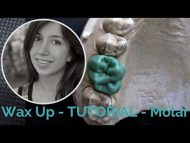 Dental Wax Up Molar 16: In-Depth Waxup Tutorial for Dental Study