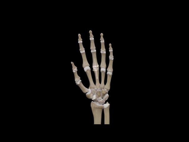 MCP Joint Surface ArthroplastySilicone - 3D Medical Animation