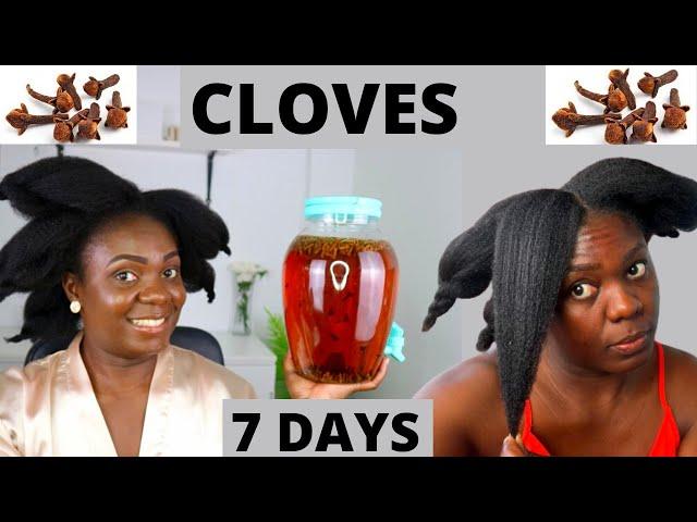 7 DAYS INTENSE CLOVES Challenge, My Hair Grew Like Crazy & Stopped SEVERE Shedding.