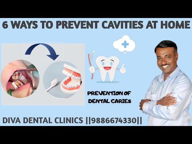 Top 6 Simple solution to prevent from Cavities || DIVA DENTAL CLINIC ||