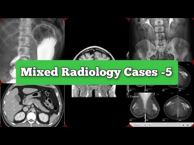 Radiology Viva Cases # 48-70 | Mixed Cases & Rapid Reporting | Auntminnie Type #medical #radiology