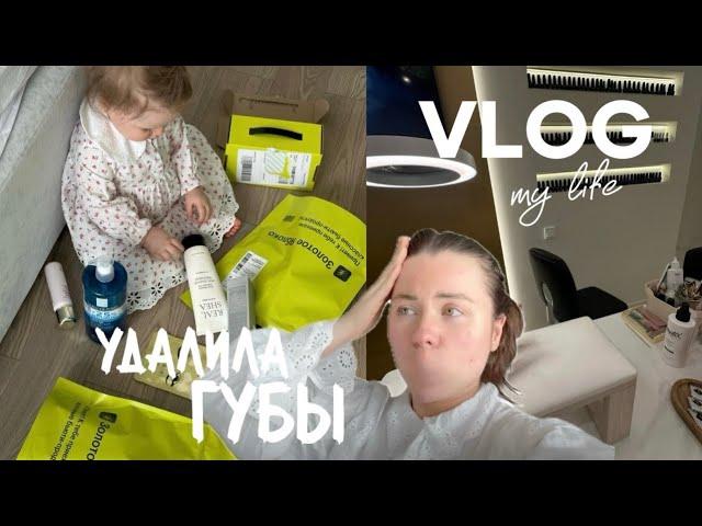 VLOG | Удалила губы из-за снега в мае, витамины от которых супер рост волос и ногтей, UNPACKING