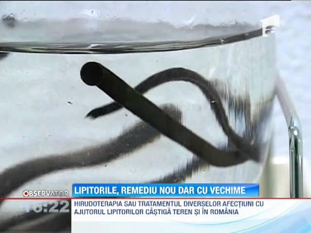 Terapia cu lipitori, cea mai nouă metodă de tratament