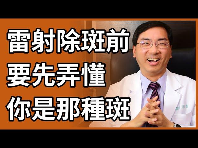 臉上各種黑斑、肝斑、曬斑，你是那一種？如何治療才有效？