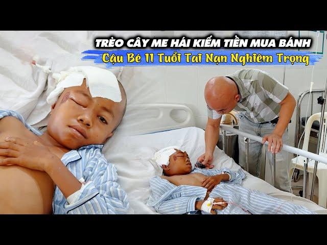 TRÈO CÂY HÁI ME KIẾM TIỀN MUA BÁNH, CẬU BÉ 11 TUỔI TAI.NẠN CHẤN THƯƠNG SỌ.NÃO