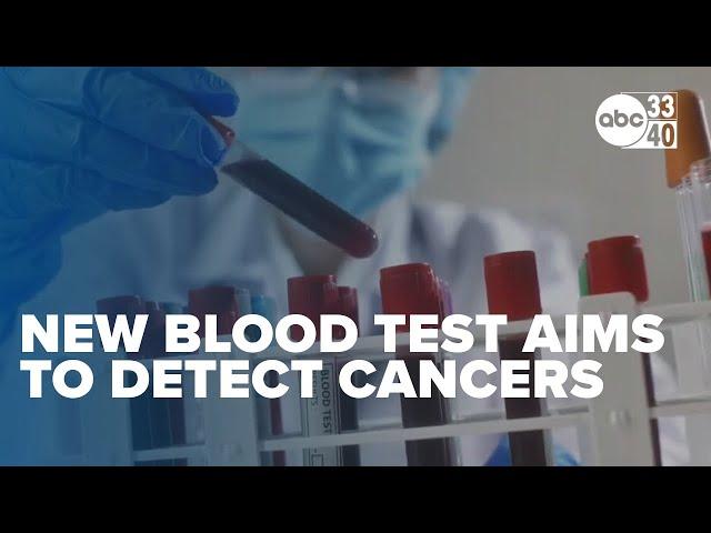 Is it accurate?: New blood test aims to detect multiple cancers before symptoms arise