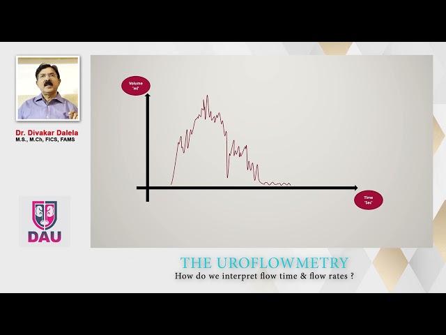 Uroflowmetry How to interpret Flow rates and times