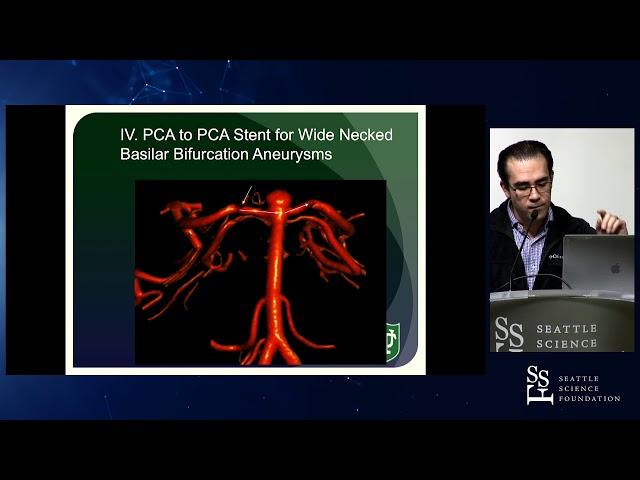 Decision Making in Clipping vs Coiling - Aaron S. Dumont, MD, MBA