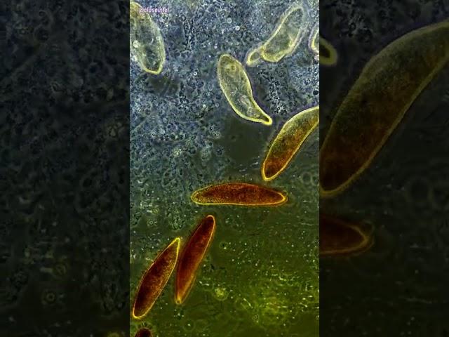 Iodine vs Germs Under Microscope (2% iodine)