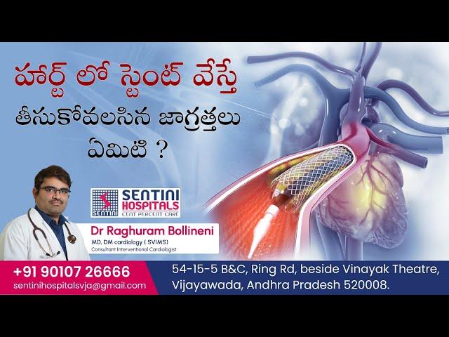 What are the precautions we should take after angioplasty or a stent procedure? #sentinihospitals