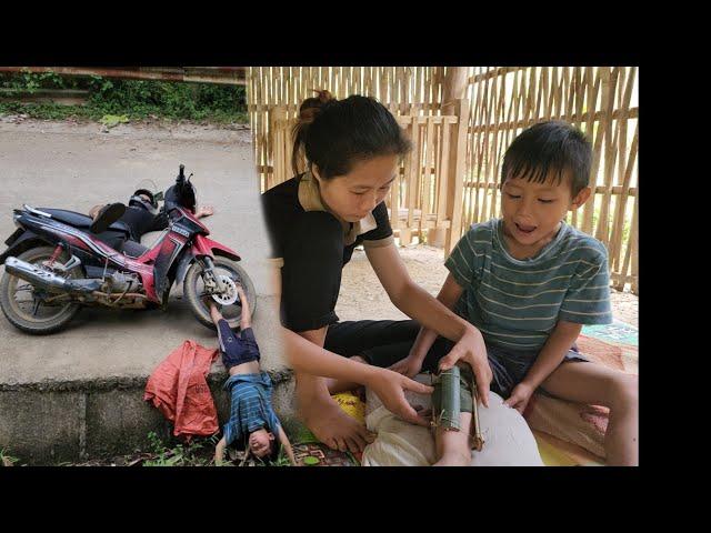 Rescued homeless boy who had an accident and brought him home for treatment | Nhì Free life