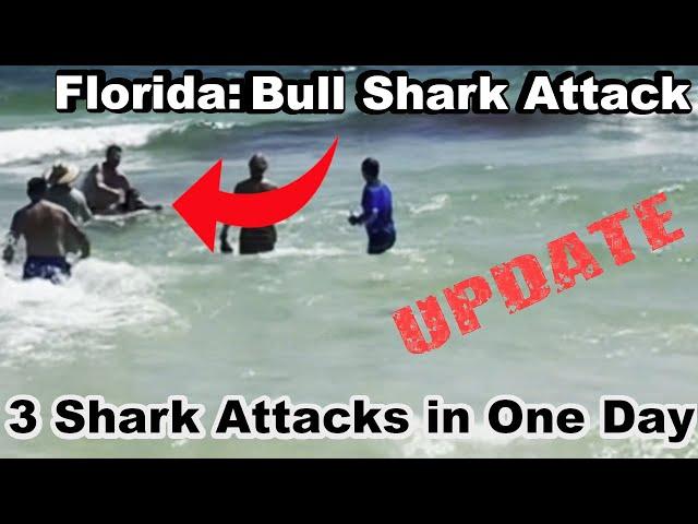 Update: 3 Florida Shark Attacks in 1 Day Teen Loses Arm & Leg to Shark Lulu Gribbin,Elisabeth Foley