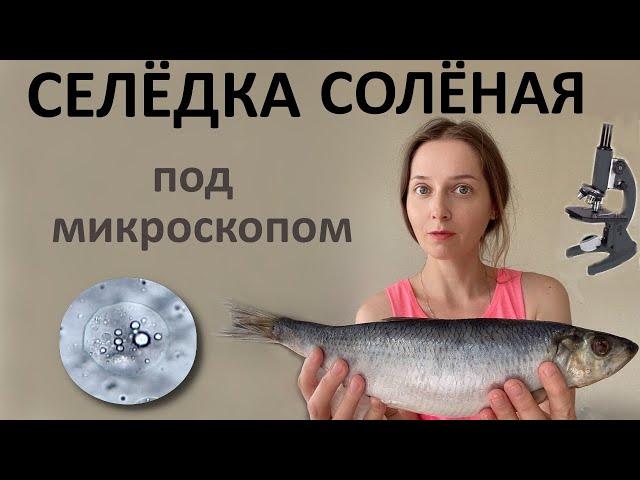 Селёдка под микроскопом. Кровь после поедания селедки кишит микроорганизмами.