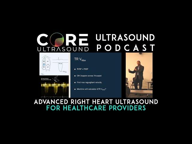 Advanced Right Heart Ultrasound for Healthcare Providers