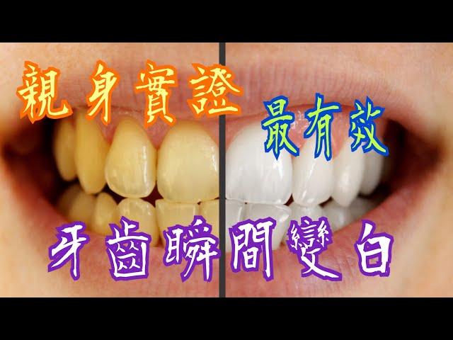 牙齒發黃不用花錢洗牙瞬間變白有效簡單更能排毒The fastest way to whiten your teeth