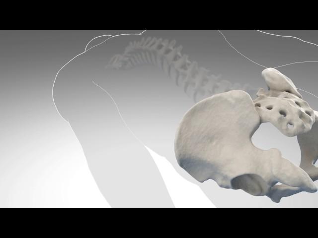 iFuse Video Sacroiliac Joint Fusion