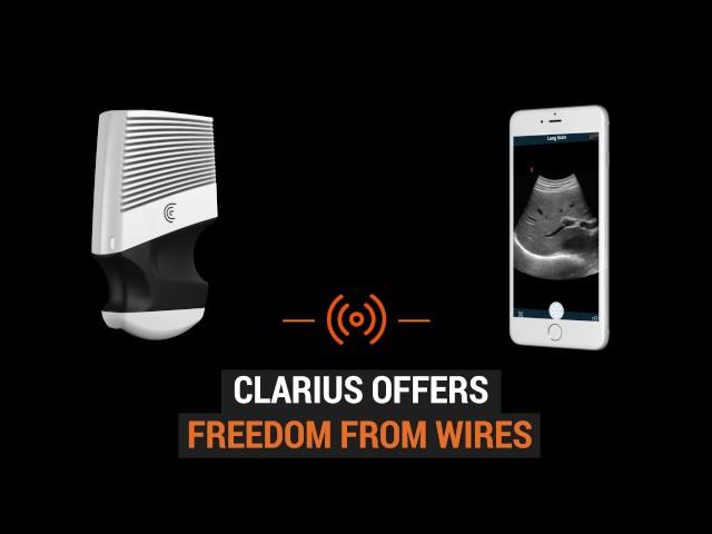 Clarius: Ultrasound Anywhere