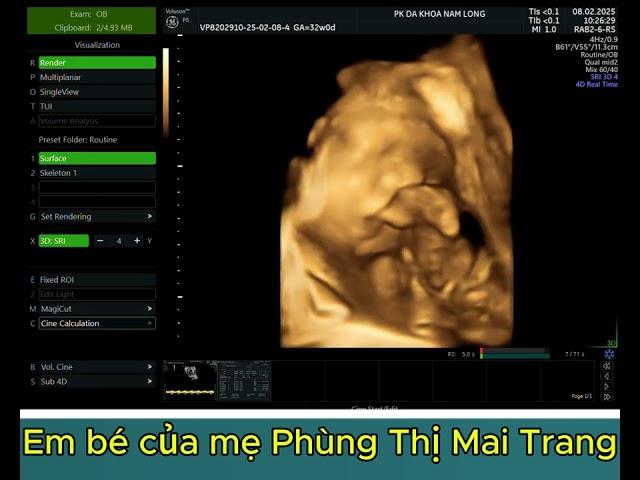 EM BÉ CỦA MẸ PHÙNG THỊ MAI TRANG - HỢP THỊNH TAM DƯƠNG VĨNH PHÚC - THAI 32 TUẦN