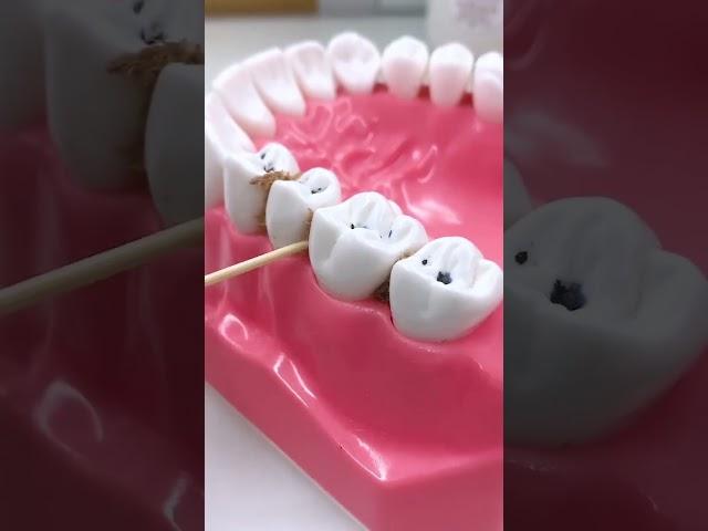  Product Link in Comments ( 295 ) Oral Breeze Dental Floss Tooth Cleaning Kit