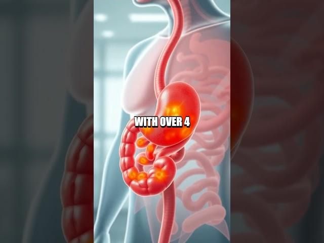 Early Signs of Peptic Ulcer Disease