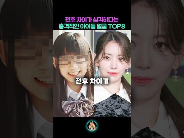 알고보면 전후 차이가 심각한 아이돌 TOP8