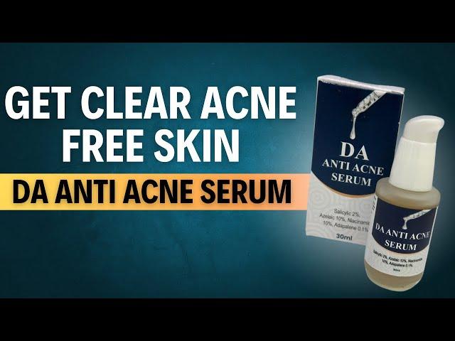 Best Anti-Acne Serum for pimples | Powerful Ingredients for Clearer Skin