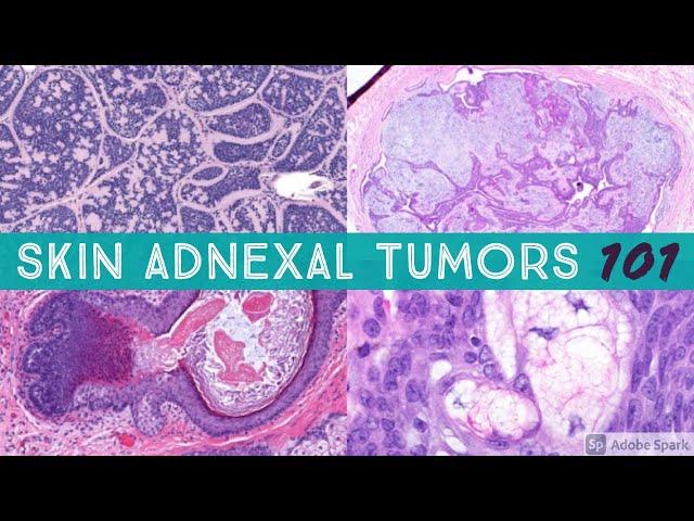 Skin Adnexal Tumors 101: A Basic Approach for General Pathologists