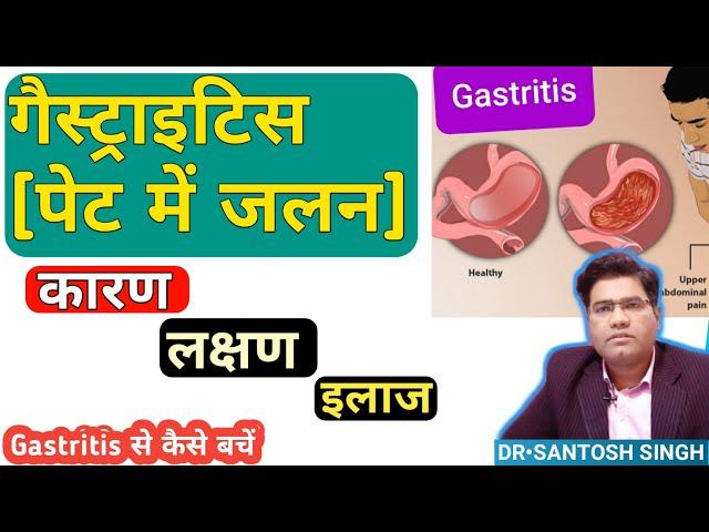 What are Gastritis Symptoms, Cause and Treatment (Explained In Hindi) | - How to Prevent it