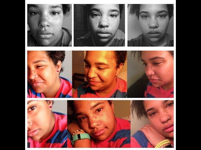 8 months off Testosterone FtM  photo series