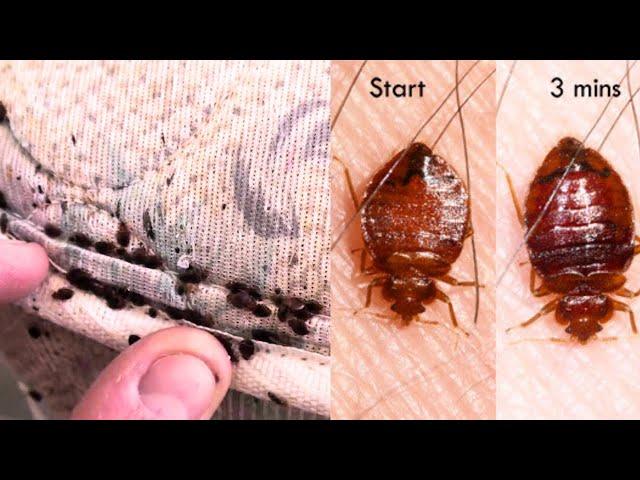 BED BUG BITES SYMPTOMS, TREATMENT, PREVENTION