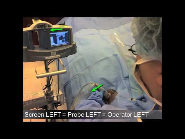 Roberts and Hedges Ultrasound Introduction