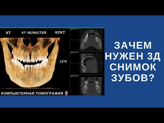 Что такое 3д снимок зубов и зачем он нужен?