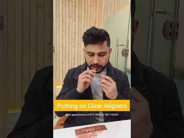 Putting on Clear Aligners- Get perfect teeth with INVISIBLE braces