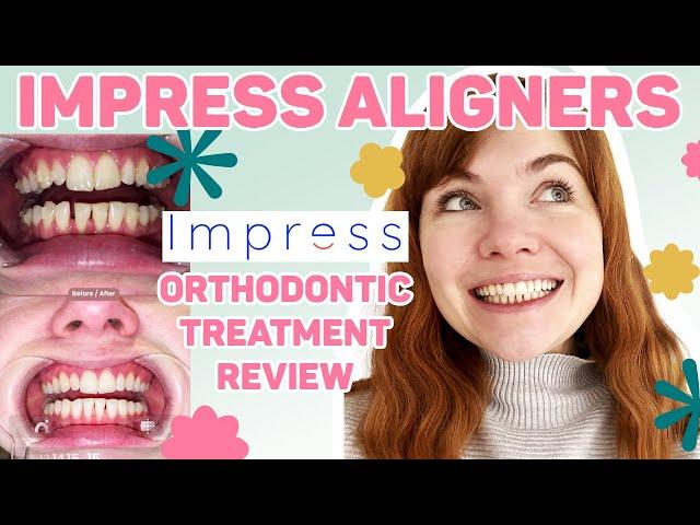 Impress Aligners Orthodontic Treatment Journey & Review | Before & After