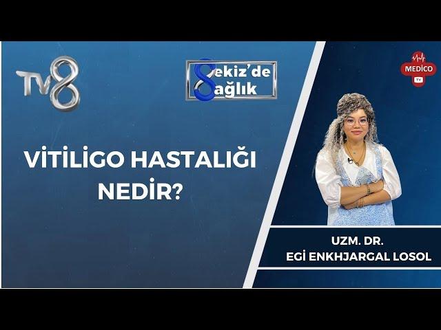 Vitiligo Hastalığı Nedir? | Uzm Dr. Egi Enkhjargal Losol | 8'de Sağlık