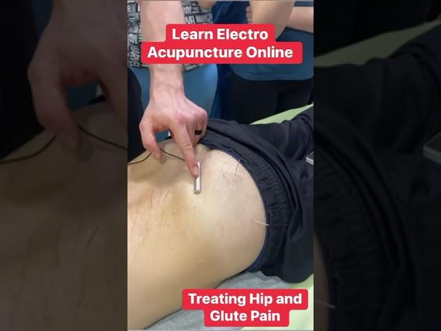 Learn electroacupuncture online now #electroacupuncture #acupuncture ￼