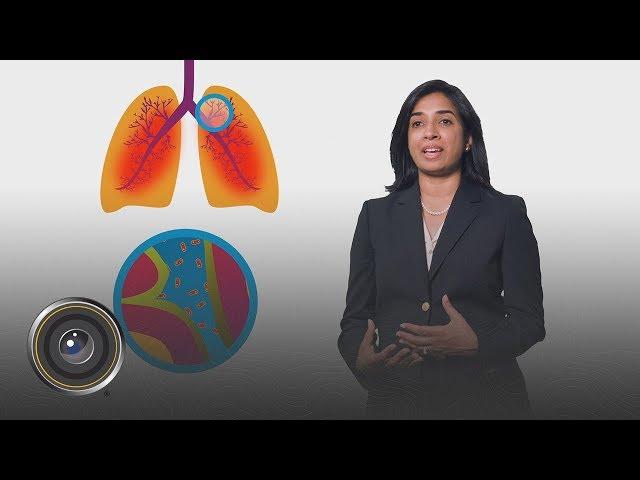 SnapShot Interactive | Cystic Fibrosis Foundation "Anti-Inflammatory"