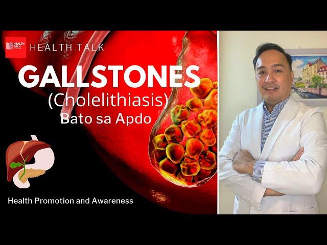 Gallstones: Causes, Clinical Features and Prevention