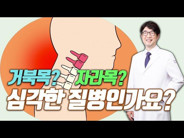 [평촌서울나우병원] 거북목이라고 진단받았어요! 심각한 건가요?