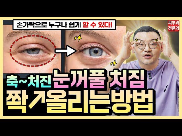 Just 3 minutes! Lift up your droopy eyelids | Use your fingers at home  Put them up! by Dr.DTS