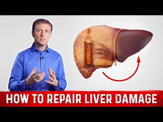 How To Repair Liver Damage After Alcohol? – Dr.Berg on Liver Cirrhosis